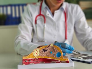 Doctor mammologist examines result of mammogram breast test with x-ray scan