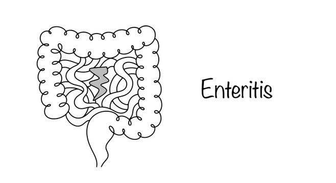 Enteritis