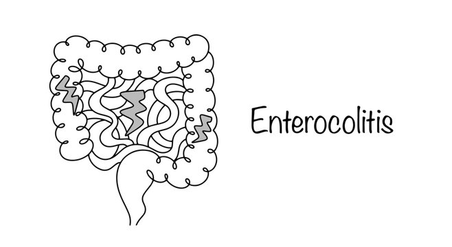 Enterocolitis