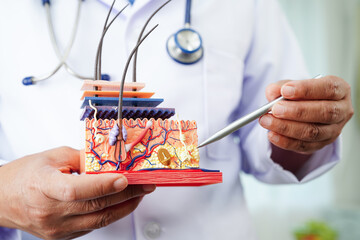 Hair transplant, Asian dermatologist doctor holding skin structure anatomy model for treatment in...