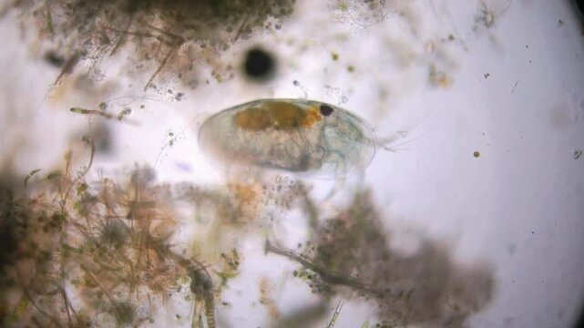 Water flea. It's a tiny crustacean with a translucent, teardrop-shaped body enclosed in a bivalve carapace. The head is not clearly visible, but a dark eye spot can be seen. It possesses several pairs