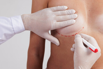 Plastic surgeon marking woman's breast on brown background, closeup
