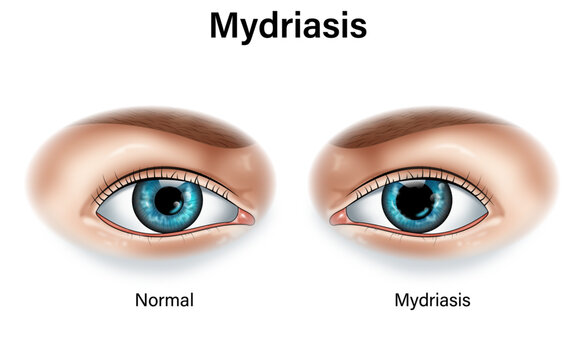 Exploring Normal and Mydriasis Eye Conditions: A Comprehensive Science Vector Illustration with Detailed Labels for Educational Purposes