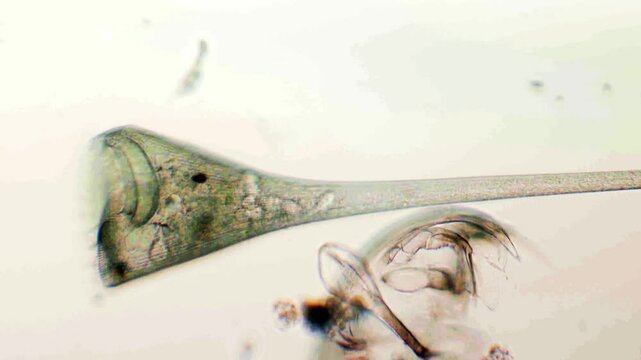 stentor, Stentor, Trumpet Animalcule,  genus of the ciliate, ciliate,