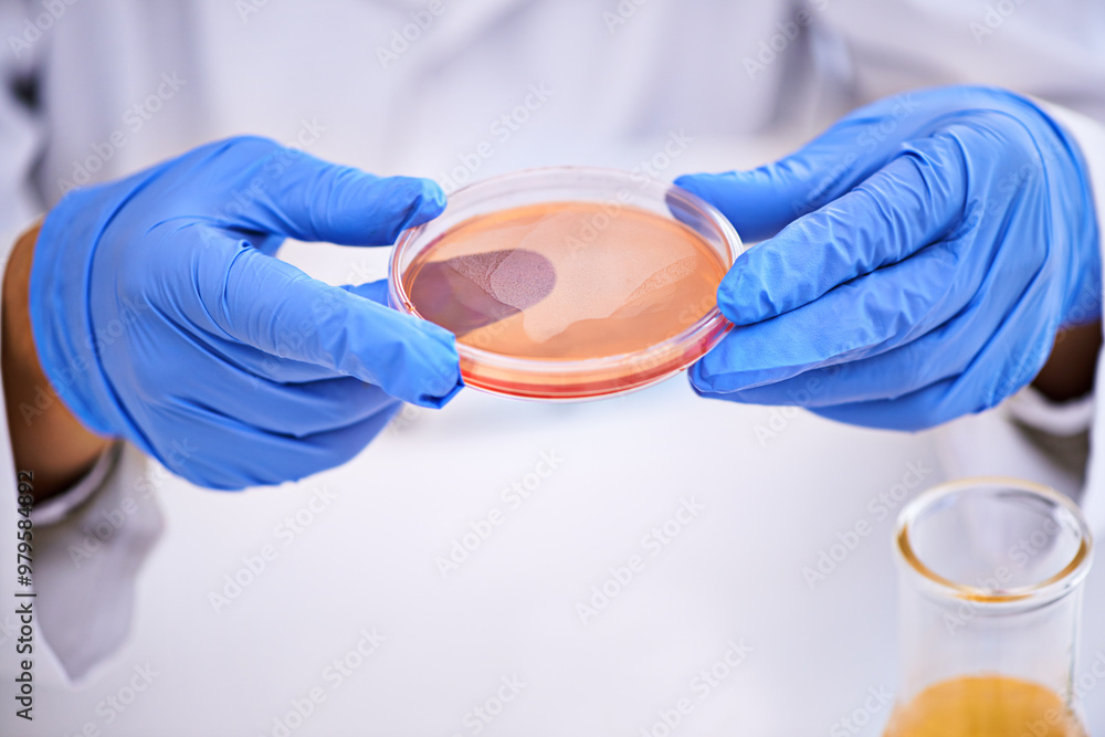 Poster Blood science, hands and Petri dish in laboratory for research, studying and monkeypox virus. Infection, disease and medical person test sample and pathology, biologist or immunity in dna innovation