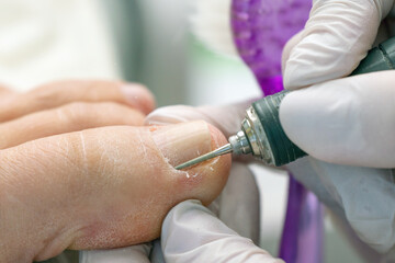 Professional hardware pedicurist, podiatrist cleaning nails using a nail miller