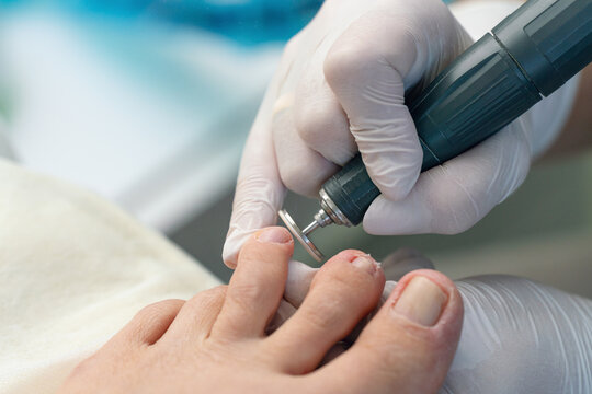 Hardware pedicure, grinding toes with an abrasive pedicure disc