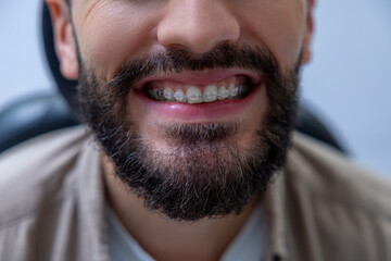 Man sitting in dental chair for orthodontic treatment receiving professional care from specialist