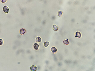 photo of archegonia spores under the microscope 