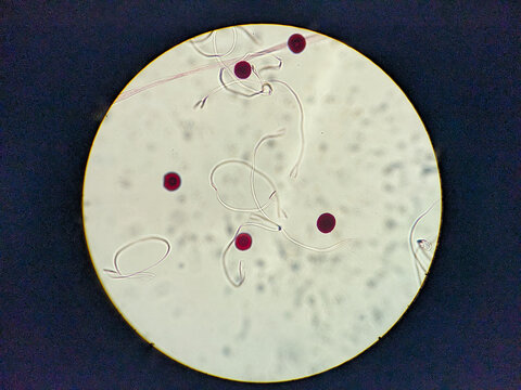 photo of archegonia spores under the microscope 