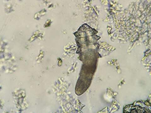photo of demodex face mite under the microscope