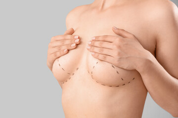 Young woman with marks on her breast against grey background, closeup. Plastic surgery concept