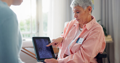 Tablet, physiotherapy and doctor with patient x ray for medical service, evaluation and online...