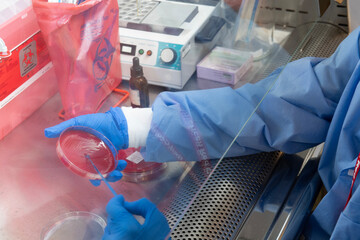 Laboratory technician tests for bacterial infection analyzes microorganisms growth Lab worker's hand holds test sample in Petri dishes Medical hospital research Disease outbreak control prevention.