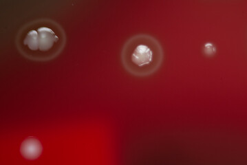 Bacterial colonies growing on agar plate.
