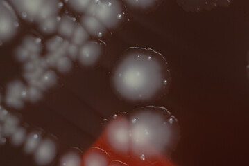 Bacterial colonies growing on agar plate.