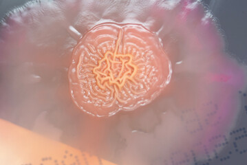 Bacterial colonies growing on agar plate.