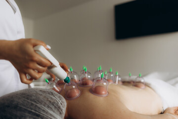 Cupping therapy. Closeup view of woman with glass cups on her back indoors