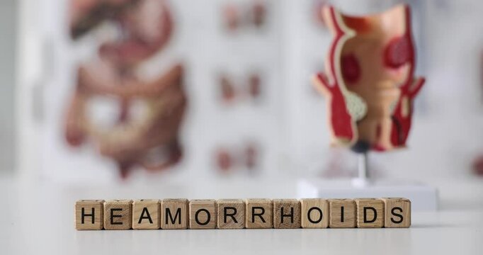 Word hemorrhoids on cubes rectal rectum model. Vascular structures in the lower rectum and concept of acute pain