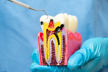 Asian dentist holding dental implant, artificial tooth roots into jaw, root canal of dental...