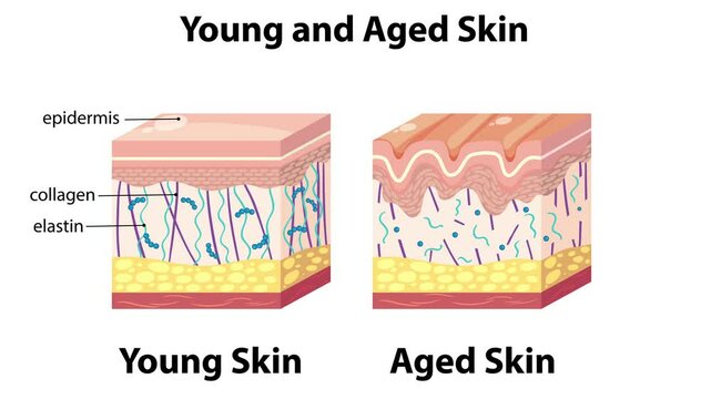 Comparison of Young and Aged Skin