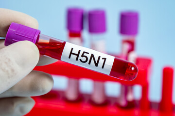 Obraz premium Blood collection tubes H5N1 bird flu test positive results,Medical health concept