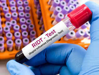 Blood Sample for H1N1Flu (swine flu) test. Influenza virus. Rapid Influenza Diagnostic Test (RIDT).
