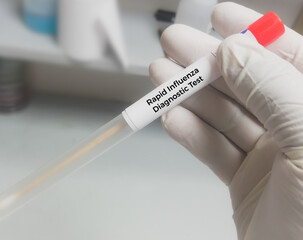 Swab Sample for H1N1Flu (swine flu) test. Influenza virus. Rapid Influenza Antigen.