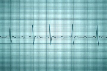 EKG waveform illustration on a grid paper background with a subtle texture, showcasing the distinct P wave, QRS complex, and T wave in accurate anatomical colors against a soft blue-gray tone.