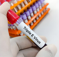 Eastern equine encephalitis (EEE) virus term, commonly called Triple E or sleeping sickness,...
