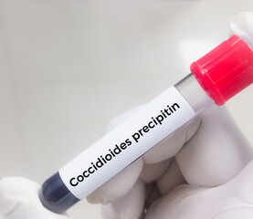 Coccidioides precipitin, a blood test that looks for infections due to a fungus called...