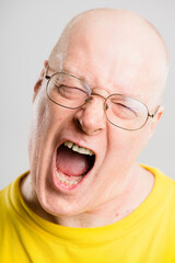 Mature man, angry and scream in studio for stress, frustrated or annoyed with alopecia crisis. Male person, upset and shout on white background for tantrum, grumpy and unhappy with hair loss disaster