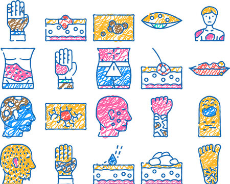 skin disease human health problem doodle icons set vector. sketch line art phytophotodermatitis and psoriasis, atopic dermatitis and angioma, hypertrichosis and angiokeratoma skin color illustrations