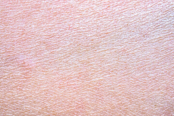 Fototapeta premium dry and dehydrated human skin texture background