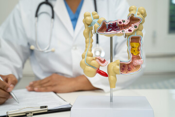 Intestine, appendix and digestive system, doctor holding anatomy model for study diagnosis and...