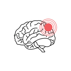 concussion brain or head ache thin line icon. linear trend modern simple logotype graphic lineart design isolated on white background. concept of