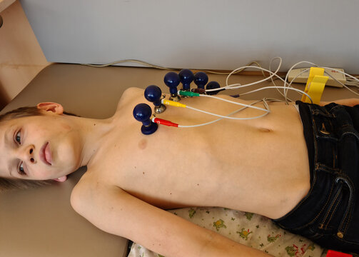 Cardiogram of the heart. A young man on a couch with attached electrodes of an electrocardiograph on his chest