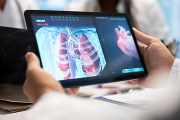 Doctors and nurses meet to discuss lungs radiography for patient care strategy in a treatment...