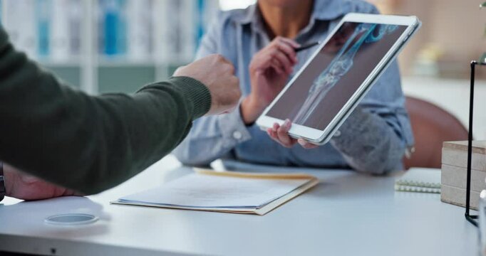 Consulting, doctor and tablet with hands of people for medical, xray or treatment plan. Healthcare, medicine and synthetic stem cell therapy with patient and bone marrow transplant breakthrough