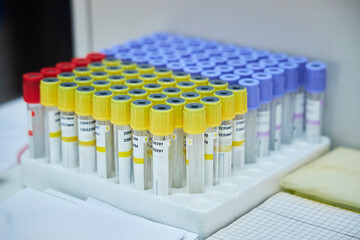 Fototapeta premium On the table there are flasks for blood analysis or other substances, many types of tubes of different colors and sizes.