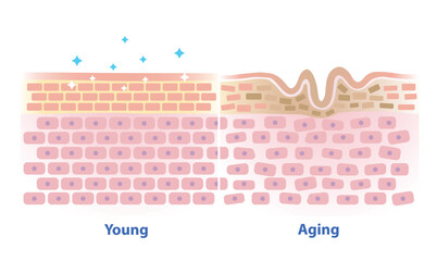 Comparison of young and aging skin vector illustration isolated on white background. Cross section of healthy and wrinkle that lose strength, flexibility and firmness on structure skin layer.