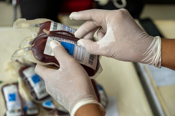 A medical worker in latex gloves holds a blood bag, showing an information label on the blood bag...