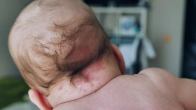 Close-up of the baby's head and neck, with a birthmark. The baby's thin hair and ear. A tender, vulnerable moment of early infancy
