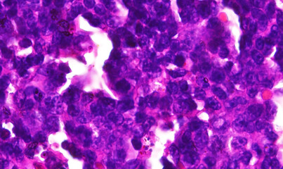 Lymphocytes, Macrophages, and Erythrocytes in Rat Spleen: A Microscopic Perspective at 400x