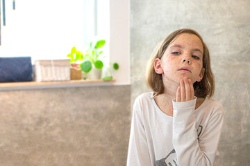 Natural vaccination. Contagious disease. Sick child with chickenpox. Varicella virus or Chickenpox...