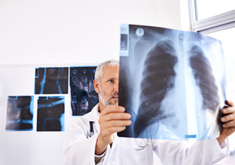 Xray, radiology and healthcare with doctor in hospital for medicine, results and tumor detection. Medical, insurance and lung cancer with mature man and scan for pneumonia or disease screening