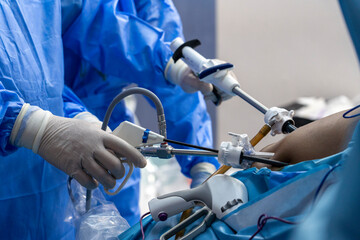 gastric sleeve surgery performing by surgeon 