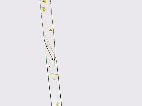 Rhizosolenia , marine phytoplankton from diatom group. Lugol preserved sample. Selective focus