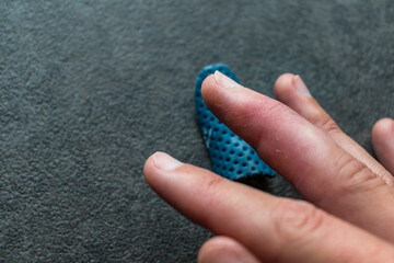 Mallet finger healing after splint removal from middle finger following joint trauma