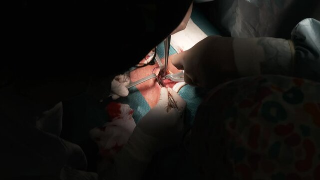 Anonymous surgeons performing operation on patient in hospital, thyroid gland removal surgery